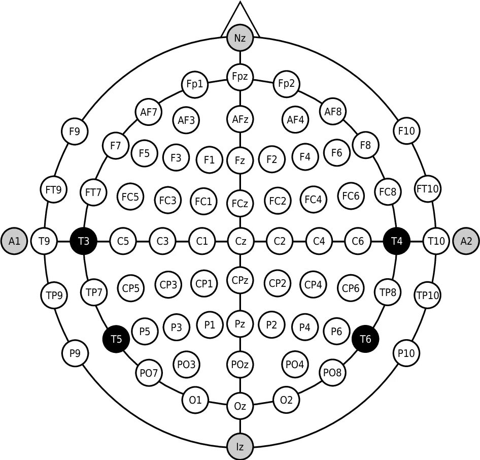 ЭЭГ схема крепления электродов. Схема ЭЭГ 10-20. Схема наложения электродов ЭЭГ. Наложение электродов при ЭЭГ 10-20.