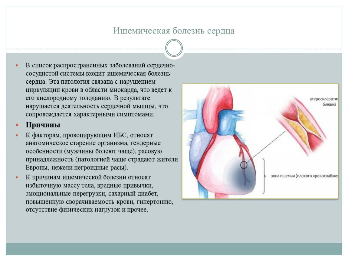 Ишемия смерть. Схема причины сердечно сосудистых заболеваний. Факторы вызывающие ишемическую болезнь сердца. ИБС (коронарная болезнь сердца). Заболевания сердца кратко.