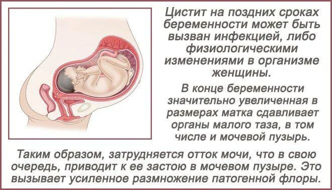 Секс Без Презерватива Во Время Беременности