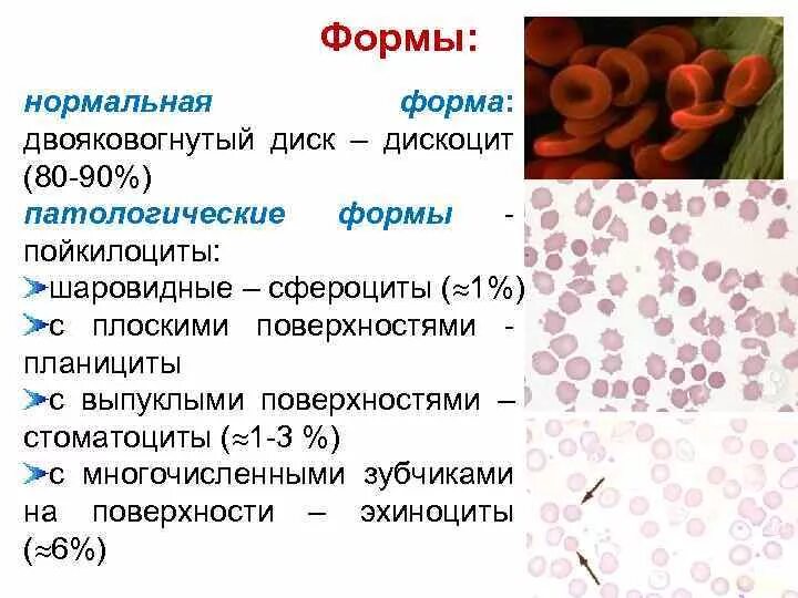 Старение эритроцитов. Стареющие эритроциты. Патологические формы эритроцитов. Процесс старения эритроцитов.