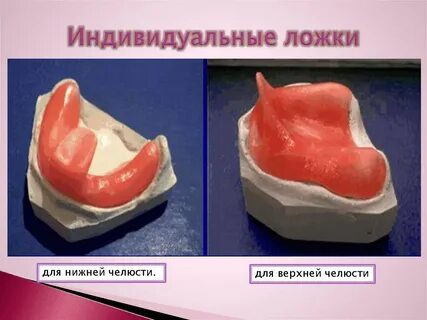 Сделать индивидуальную