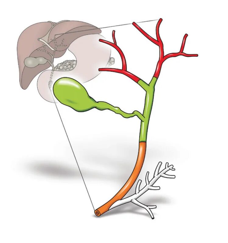 Холангиокарцинома клацкина. Желчный пузырь и желчные протоки анатомия. Воротная холангиокарцинома. Холангиокарцинома желчных протоков. Сосуды желчного пузыря