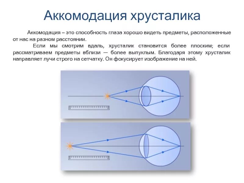 Что видит какой то предмет. Механизм аккомодации глаза схема. Схема аккомодации хрусталика. Схема преломления лучей хрусталиком глаза при рассматривании близко. Хрусталик при напряжении аккомодации.