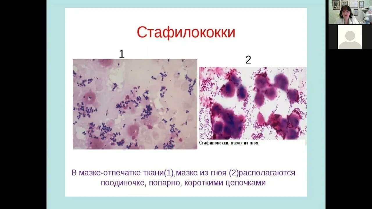 Врачи золотистый стафилококк. Сифилисный стафилококк. Стафилококк и стрептококк в мазке. Стафилококк проявления.