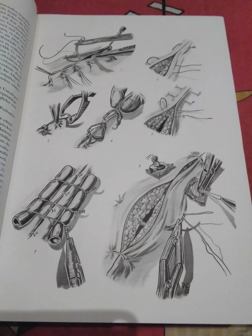 атлас по оперативной хирургии. атлас торакальной хирургии. атлас оперативной хирургии позвоночника. атлас оперативной хирургии. оперативная хирургия учебник.