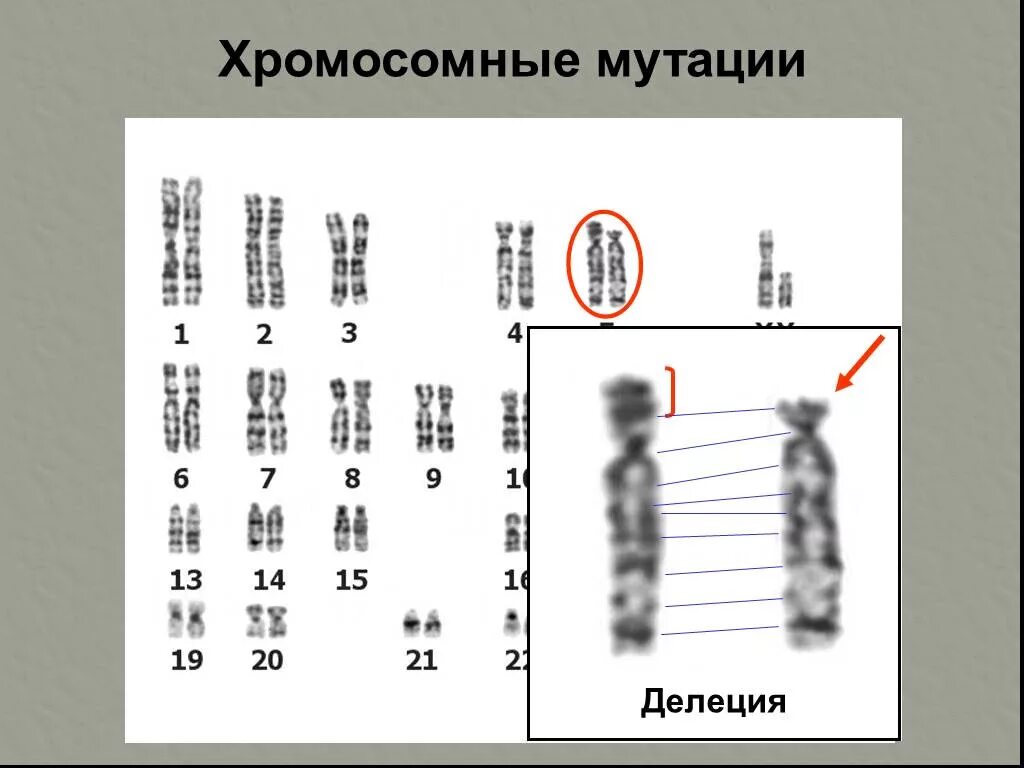 Геномные и хромосомные мутации таблица. Хромосомные мутации делеция дупликация. Нарушение структуры хромосом. Инверсия хромосомная мутация.