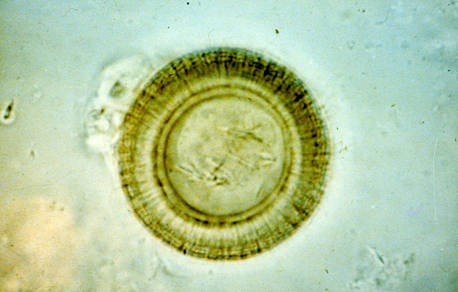 Строение яйца свиного цепня. Яйца гельминтов бычьего цепня. Строение яйца карликового цепня. Яйца тениид под микроскопом. Яйцо бычьего цепня.