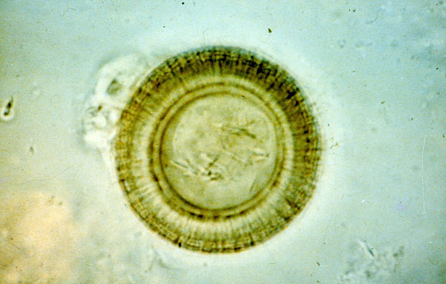 Онкосфера свиного цепня. Онкосфера карликовый цепень. Бычий цепень онкосфера. Яйца бычьего цепня микроскоп. Яйцо с онкосферой