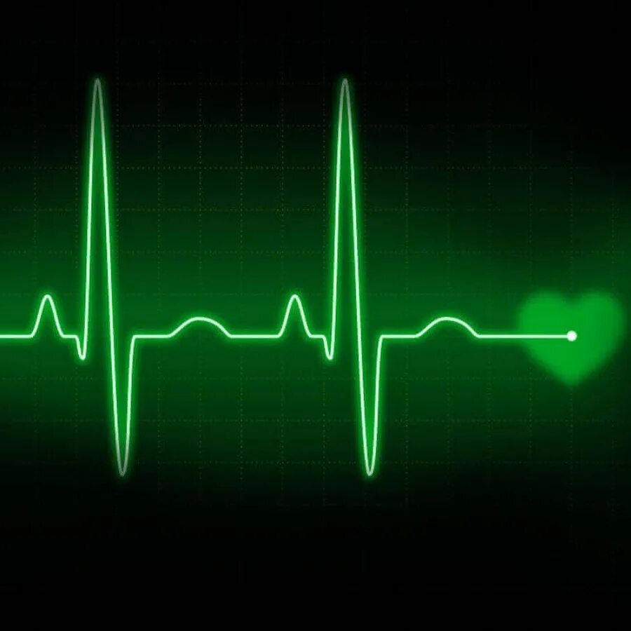 Сердцебиения 27. Пульс. Пульс сердца. Кардиограмма. Ритм сердцебиения.