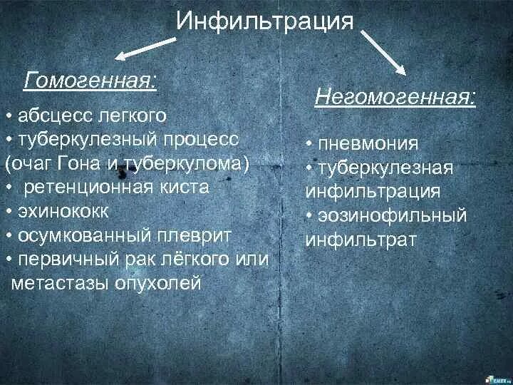 Синдром инфильтрата