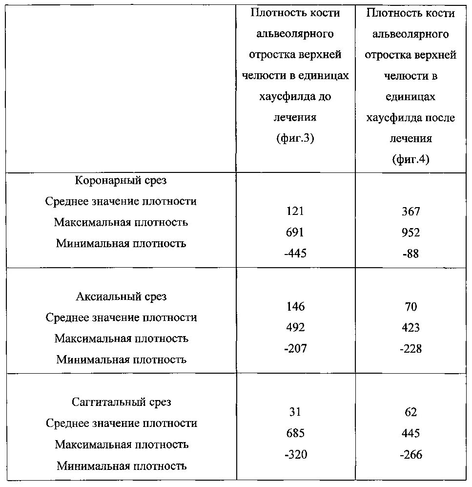 Исследование плотности костей. Плотность костей. показатели плотности кости. измерение плотности костей. анализ на плотность костей.