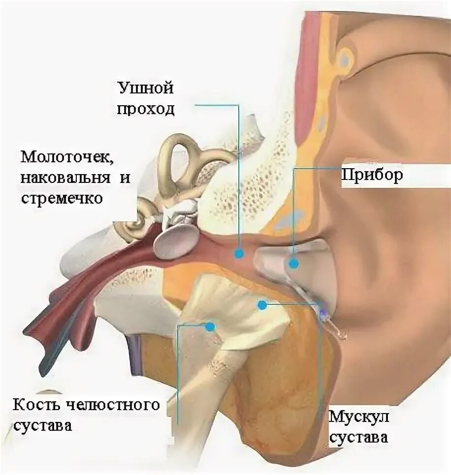 Внчс уха. Воспаление височно-нижнечелюстного сустава. Височнониднечеобстной чустав воспаление. Неврит височно нижнечелюстного сустава. Воспаление сустава ВНЧС.