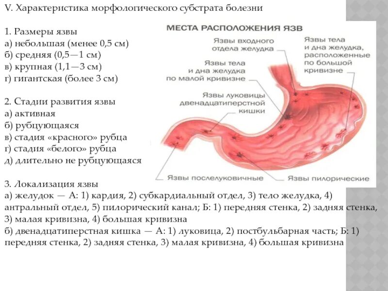 Гастрит форум врачей. Эндоскопическая классификация язвы ДПК. Язва кардиального отдела. Язва желудка стадии для диагноза.