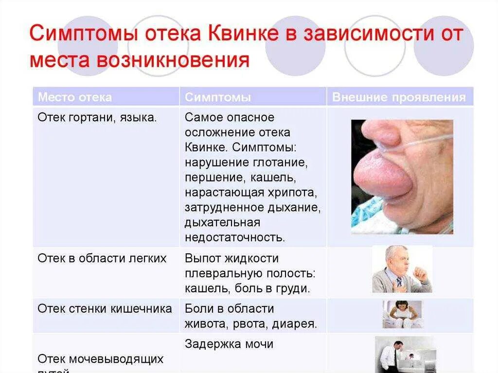 Отёк Квинке симптомы первая помощь. Основные проявления отека Квинке. Хорошо осложнение