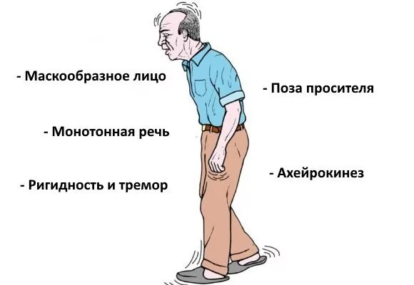 Симптомы при паркинсонизме. Болезнь паркинсона поза просителя. Походка больного паркинсоном. Походка больного паркинсоном. Двигательные нарушения при болезни паркинсона.