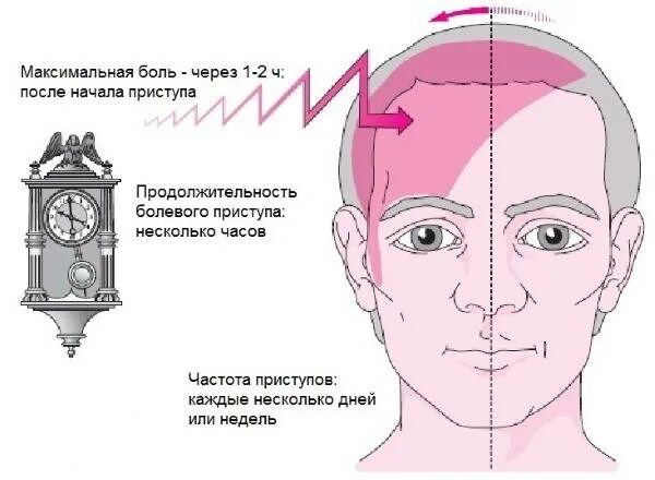 Болит лоб между бровей. Левая часть лба болит над бровью причины. Головная боль над бровями. Болит лоб над левой бровью.