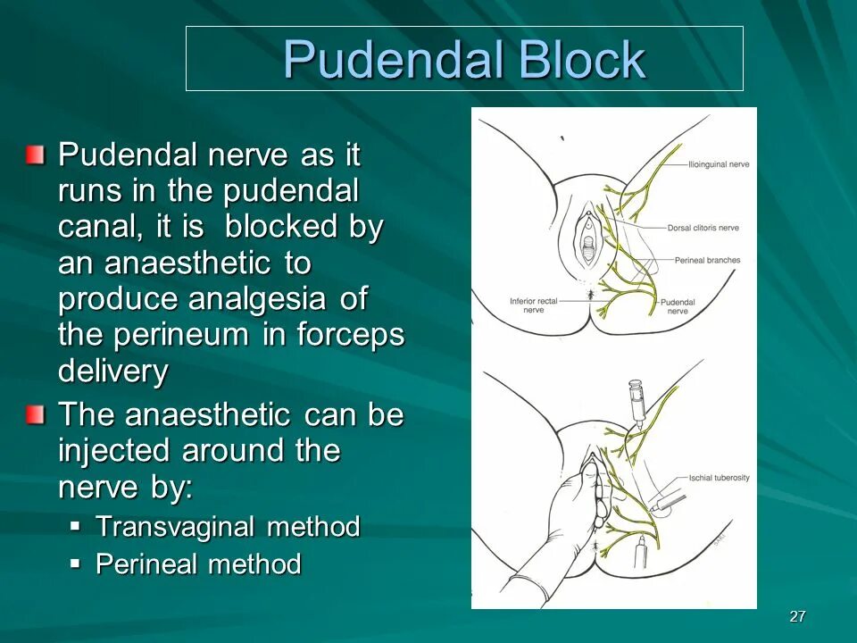 Блокады половые. Пудендальный нерв. Пудендальный (срамной) нерв.