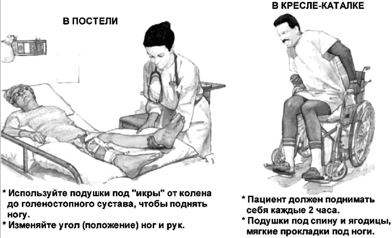 Уязвимое положение. Положения пациента профилактика пролежней. Пролежни у тяжелобольных пациентов профилактика пролежней. Профилактика пролежней тяжелобольного пациента. Сестринские вмешательства по профилактике пролежней.