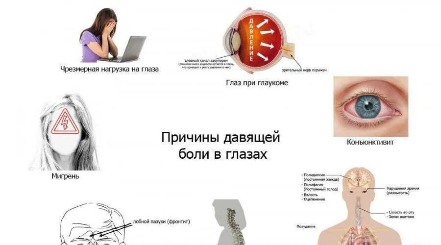 Проснулся болит глаз. Голова болит и глаза болят.