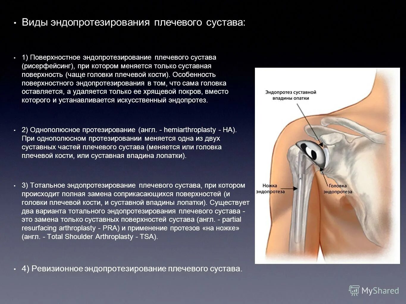 Температура при трещине