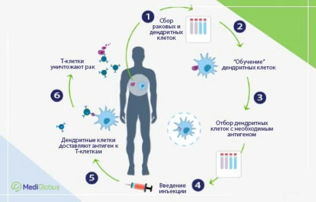 Дендритные вакцины. Противоопухолевые вакцины на основе дендритных клеток. Дендритно клеточная вакцина. Этапы иммунотерапии опухоли с помощью дендритных клеток.