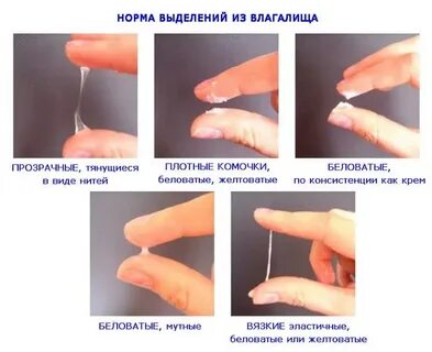 Выделение после месячных что делать