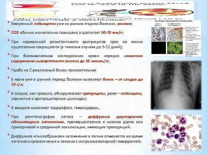 Умеренный лейкоцитоз. Незначительный лейкоцитоз. Степени лейкоцитоза. Умеренный лейкоцитоз в крови. Снижение лейкоцитоза