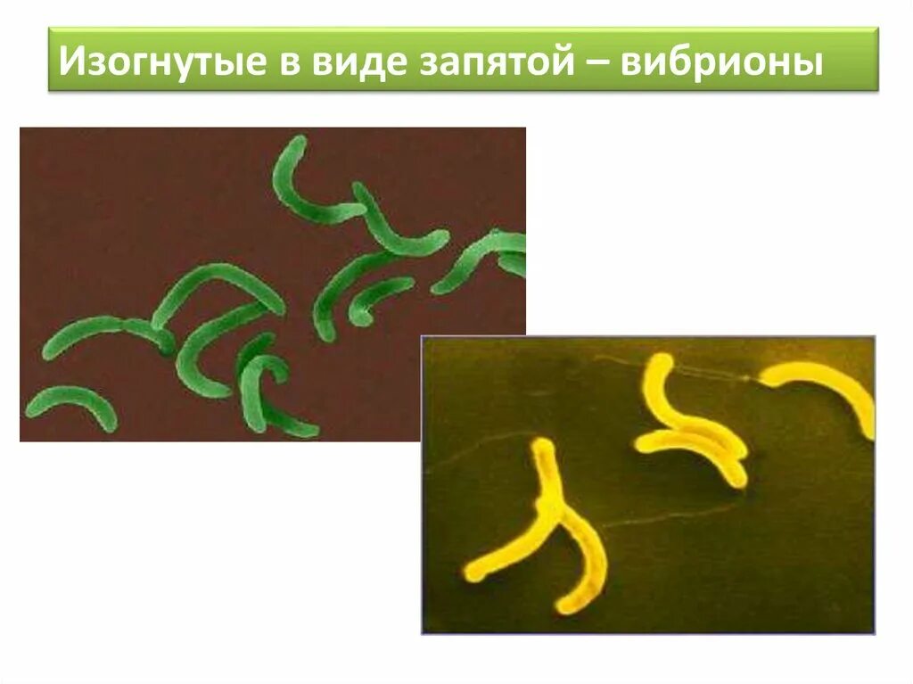 Бактерии изогнутой формы носят название. Изогнутые вибрионы. Изогнутые в виде запятой. Бациллы изогнутые в виде запятой. Вибрионы в виде запятой.
