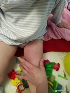 Ножки прививки
