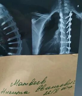 Институт позвоночника