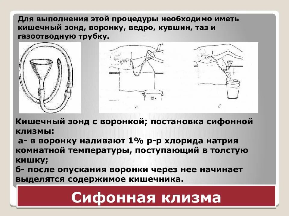 При постановке сифонной клизмы зонд вводят