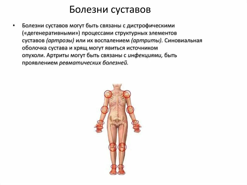 Больные суставы болезнь. Болезни поражения суставов. Заболевания суставов список. Болезни суставов названия список. Заболевание суставов название.