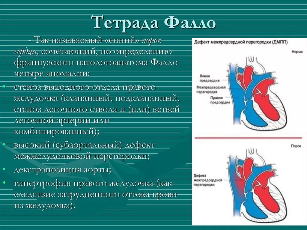 Впс премиум