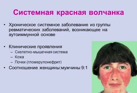 Заболевания с использованием