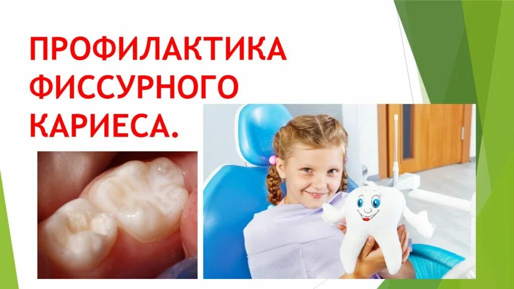 Проведение профилактики кариеса. Профилактика кариеса у детей. профилактика фиссурного кариеса. профилактика кариеса презентация.