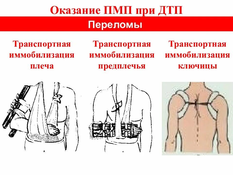 Перелом позвоночника при дтп. Оказание первой мед помощи при открытых переломах. Оказание первой помощи. Носилки скорой помощи. Оказание первой неотложной помощи.