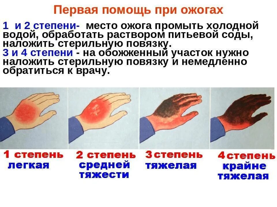 Степени ожогов и помощь. Степени ожогов и помощь