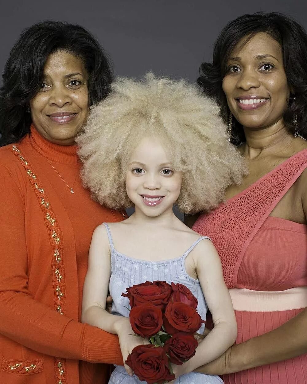 Ава Кларк — афроамериканка-альбинос.. Необычные дети. Самые необыкновенные дети. Самые необычные дети. 5 удивительных детей