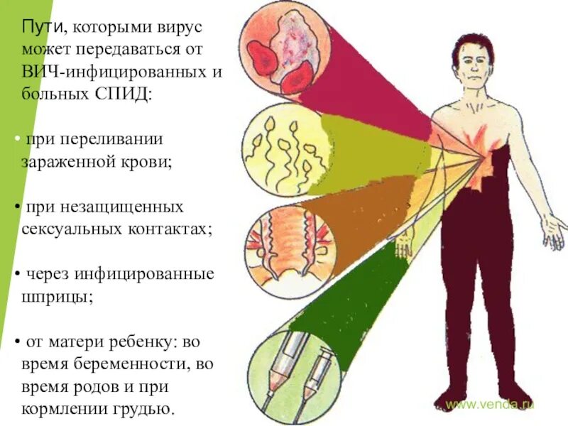 Спид 21. Презентация по ВИЧ. Вирус СПИД И человек динамика борьбы. Социальные болезни СПИД.