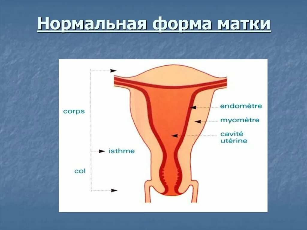 Форма полости матки. Форма матки. Грушевидная матка. Правильная форма матки.