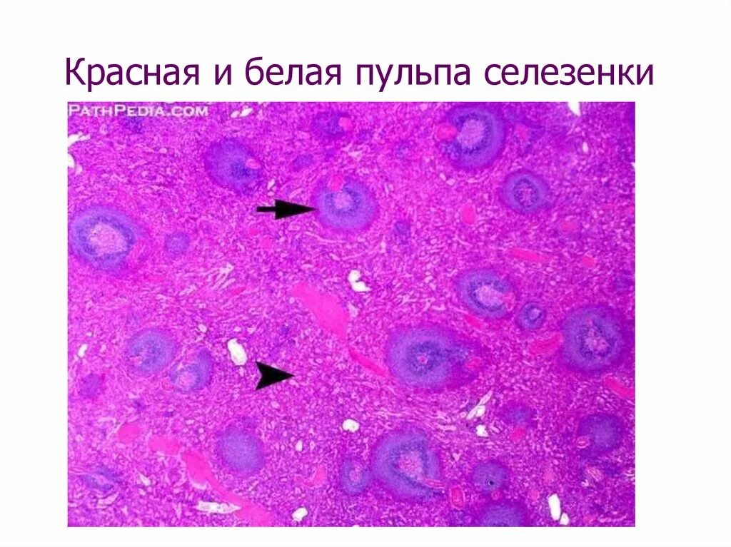 Ткань селезенки. Красная пульпа селезенки гистология. Селезенка гистология препарат. Красная и белая пульпа селезенки. Красная пульпа селезенки гистология строение.