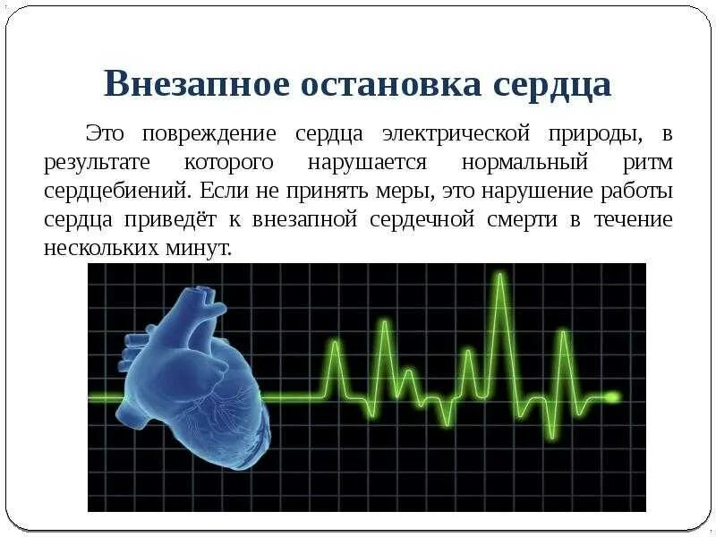 Сердце остановка сердца. Пульс остановка сердца. Причины остановки сердца. Сердце остановилось у человека. Почему бьется пульс