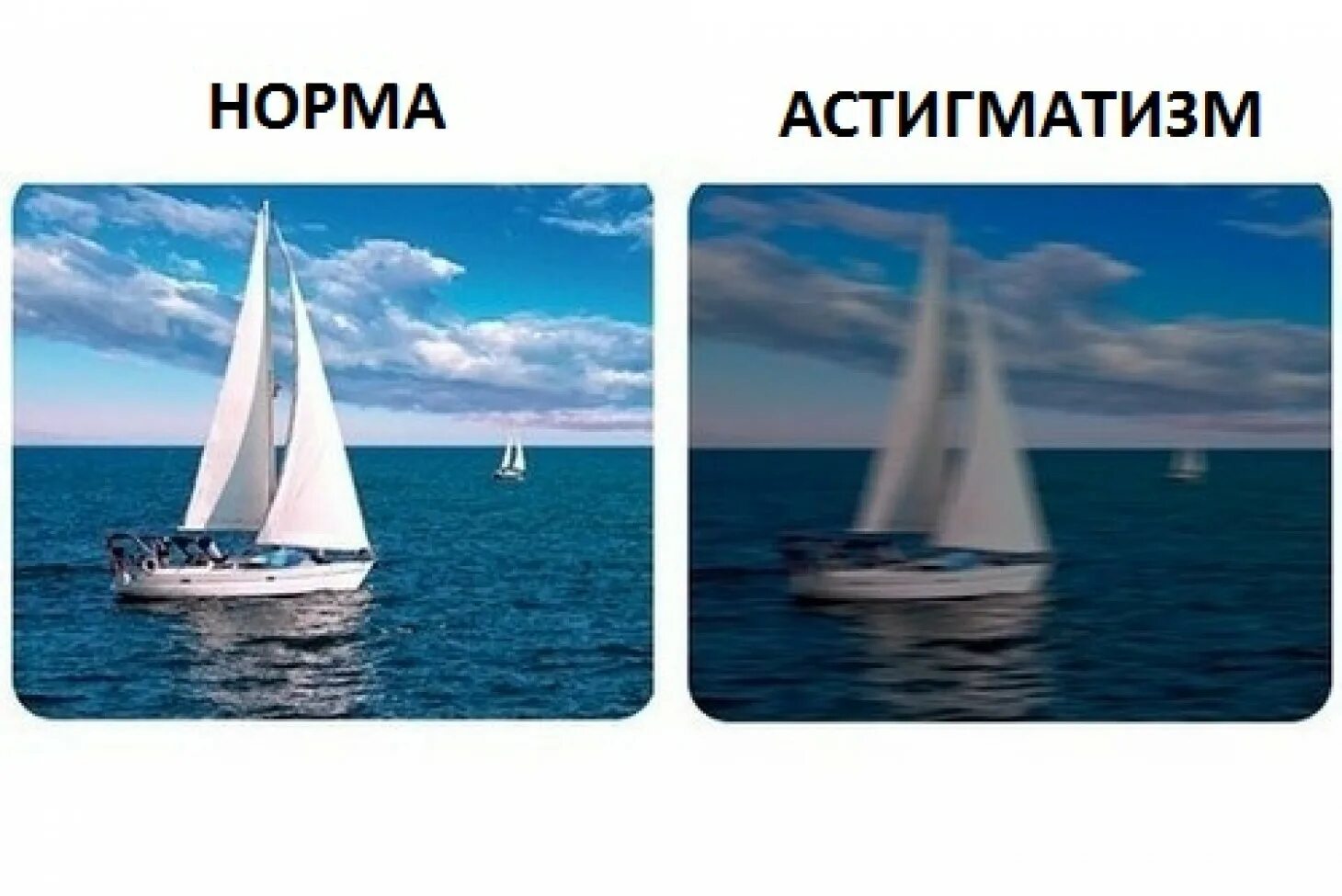 Астигматизм как видят ночью. Зрение при астигматизме. как видит человек при астигматизме. мир с астигматизмом. люди с астигматизмом и без.