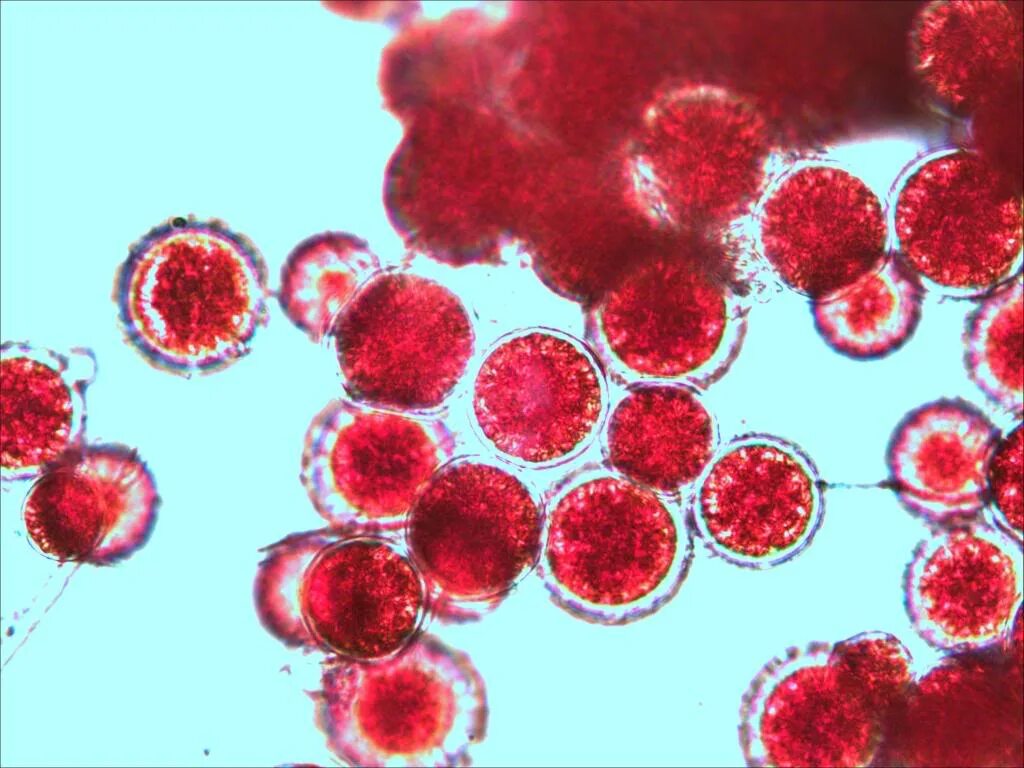 Красные водоросли клетки. Дуналиелла солоноводная. Дуналиелла водоросль. Haematococcus Pluvialis водоросли. Микроводоросли Гематококкус- астаксантин.