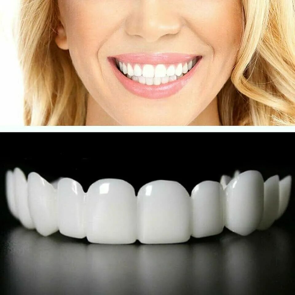 Сколько по времени делают зубы. Виниры комплект Snap-on smile. Съемные виниры Snap-on smile.