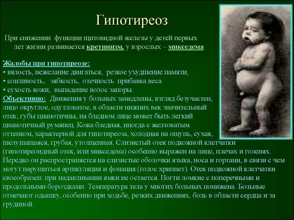 Проявления гипотиреоза внешние. Гипотиреоз диагностика симптомы и лечение. Гипотиреоз статьи. Гипотиреоз статьи. Первичный гипотиреоз не развивается при:.