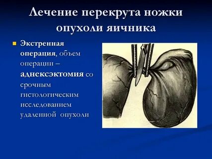 Ножки опухоли