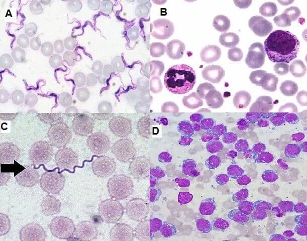 Боррелии возвратного тифа. Боррелии микробиология. Borrelia окраска по романовскому гимзе. Романовскому гимзе микробиология микробиология. Боррелия по романовскому гимзе.