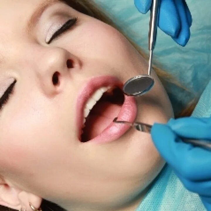 Зубной сегодня. Медикаментозный сон в стоматологии. Под наркозом закисью азота коренной зуб. К чему снится лечить зубы.