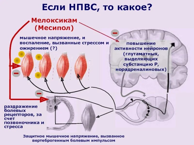 Защитное мышечное напряжение. Раздражение болевых рецепторов. Напряжение мышц. Электромеханическое напряжение мышц.